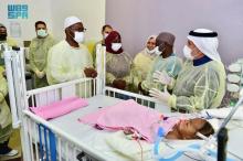 Condition of Nigerian Siamese Twins Stable after 48 Hours of Surgery
