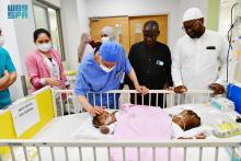 Saudi Medical Team Begins Separating Nigerian Conjoined Twins Hassana and Hasina