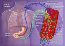 Indian Scientists Find Neurological Link To Type II Diabetes: Report  